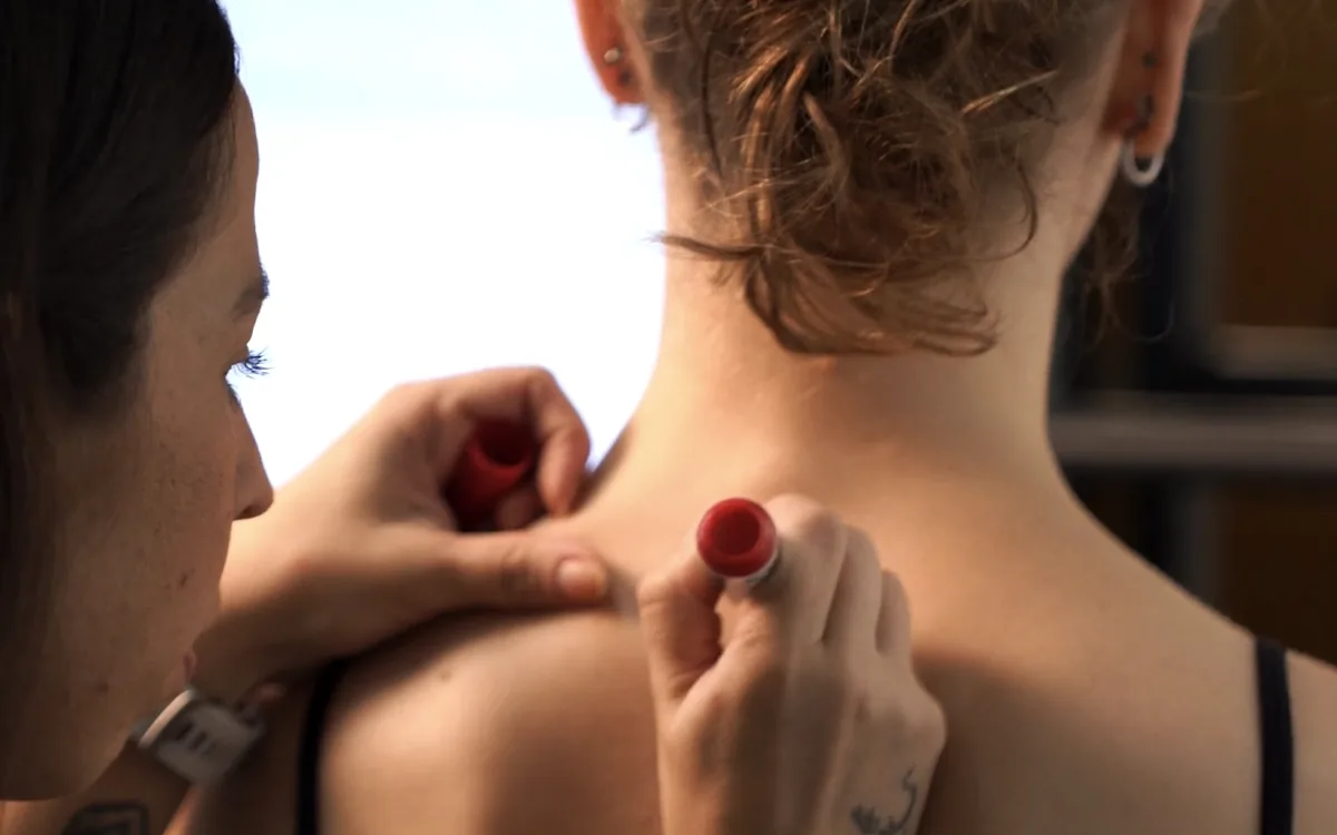 Fisioterapeuta marcando pontos de referência na coluna de uma paciente durante a avaliação postural